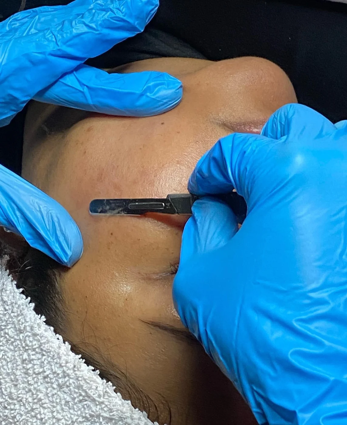 Dermaplaning facial treatment at Victoria Edward Spa in Longwood, FL