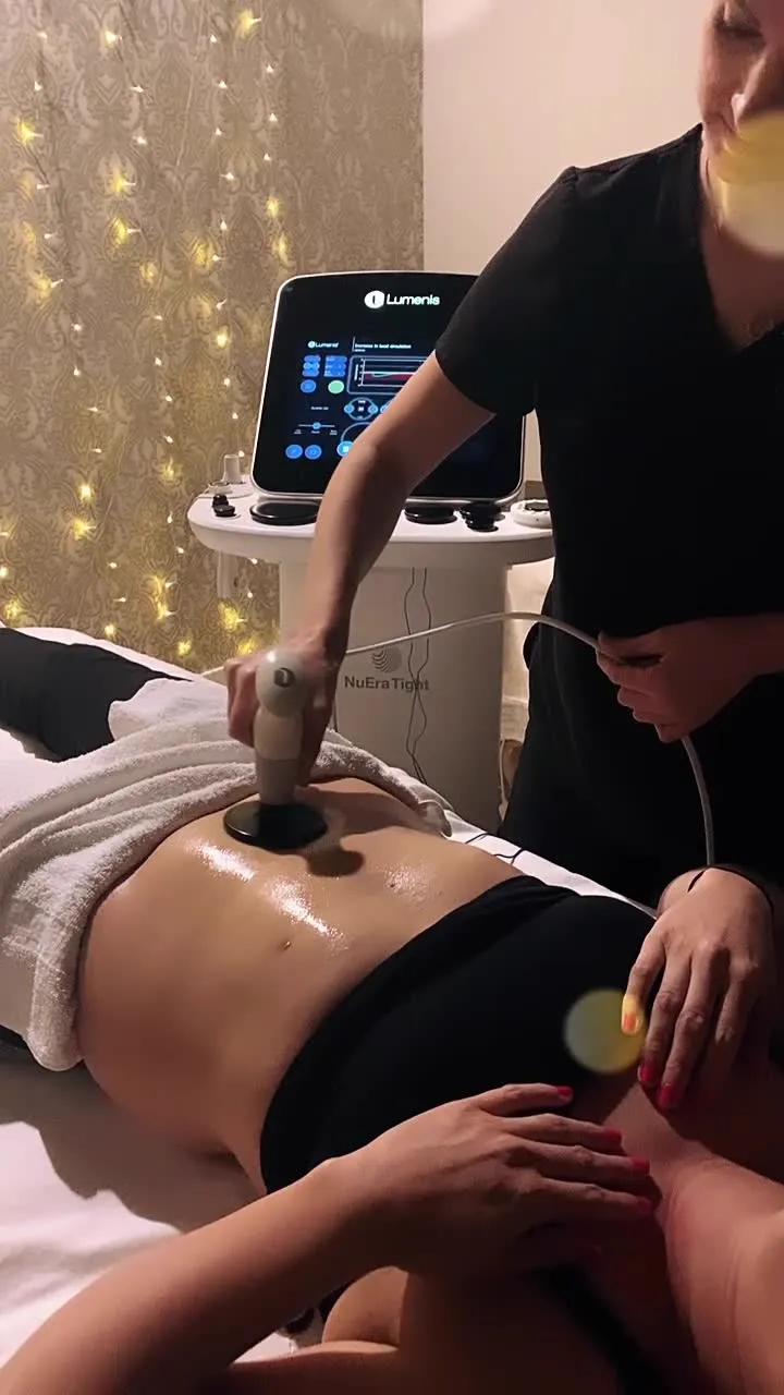 NuEra Tight skin tightening in Longwood, FL: radiofrequency treatment on the abdomen at Victoria Edward Spa