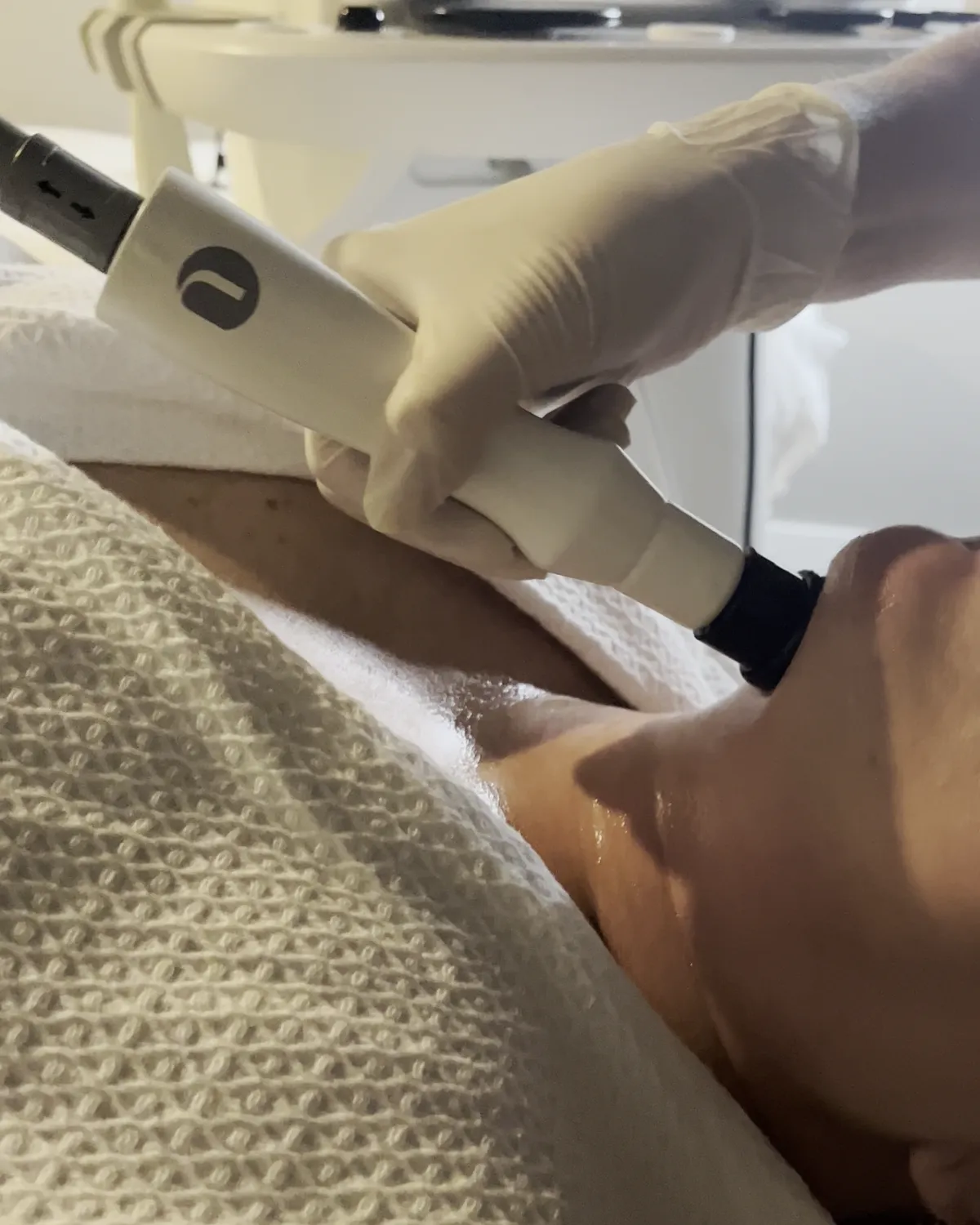 RF skin tightening in Longwood, FL: the NuEra Tight applicator on the jawline at Victoria Edward Spa