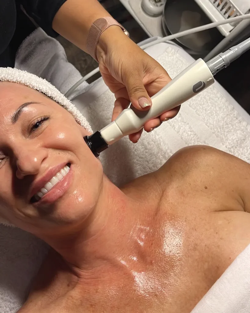 NuEra Tight in Longwood, FL: radiofrequency skin tightening on the neck and chest at Victoria Edward Spa