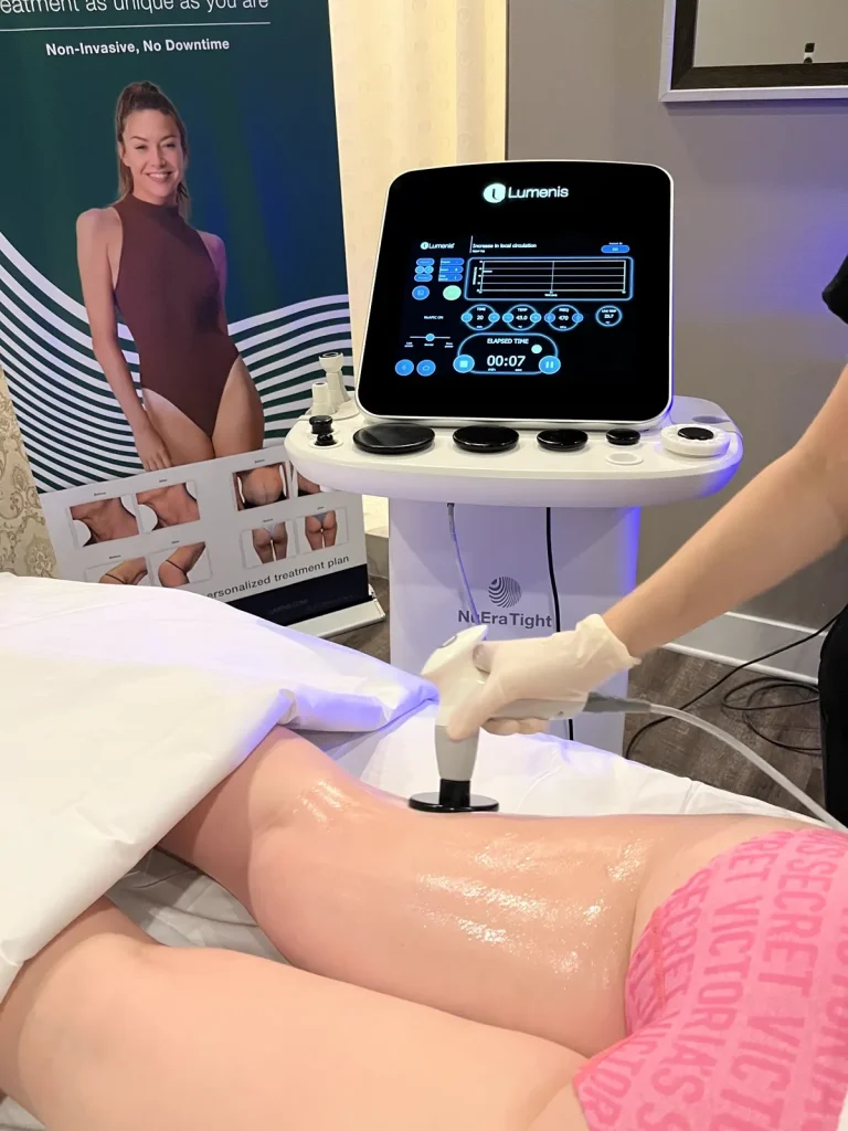 Body contouring in Longwood, FL with the NuEra Tight device at Victoria Edward Spa